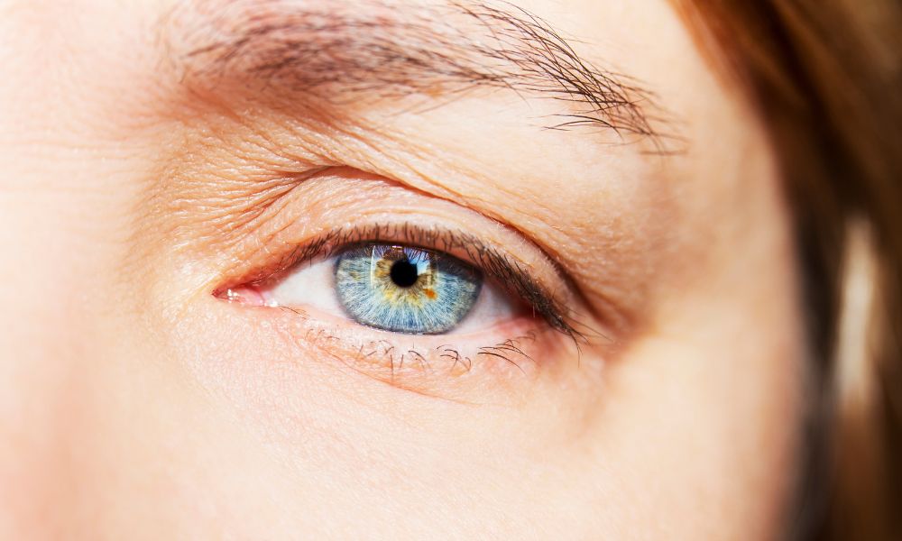 The Pros and Cons of Cosmetic Eyelid Surgery
