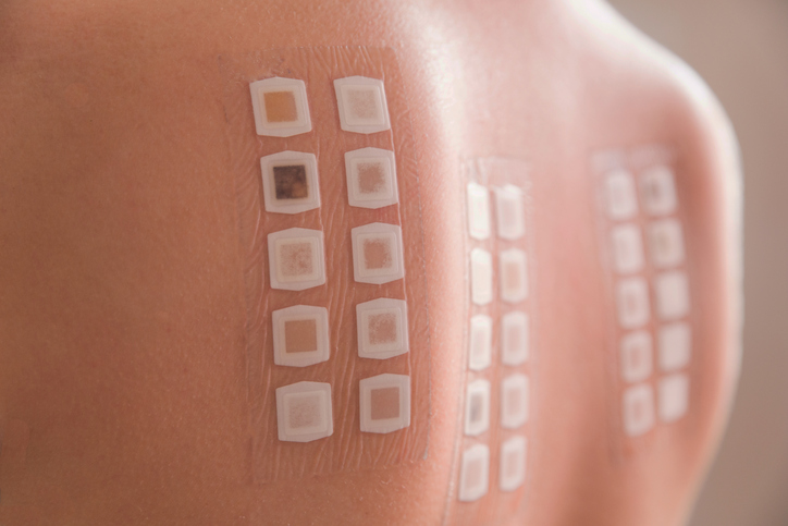 allergy patch test