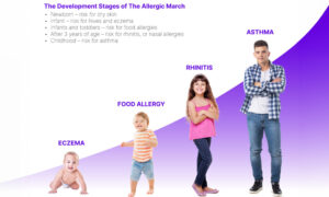 What is the allergic march?