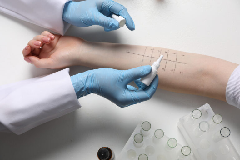 first time allergy testing