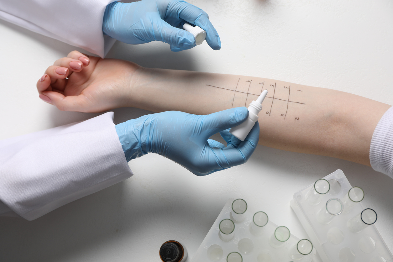 first time allergy testing